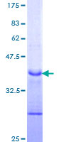 12.5% SDS-PAGE Stained with Coomassie Blue.